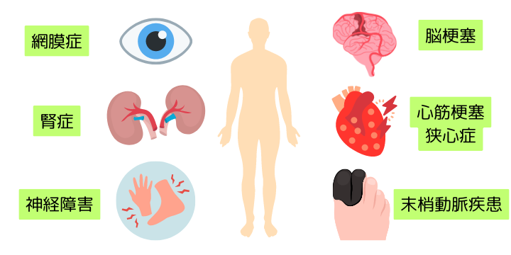 糖尿病合併症一覧