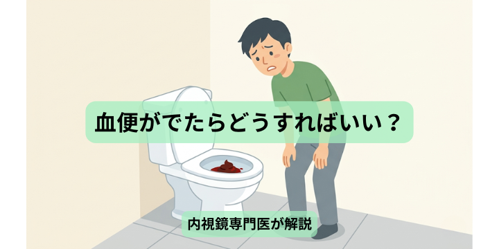 大阪市平野区・東住吉区・生野区の血便精査、大腸カメラはやまおか内科クリニック