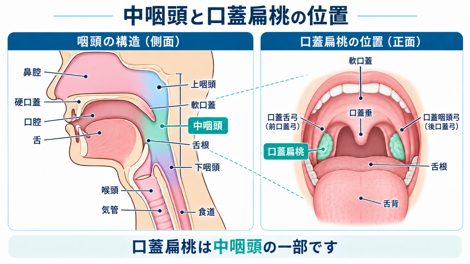 中咽頭がんと扁桃がんが発生する場所を示す図。上咽頭・中咽頭・下咽頭と口蓋扁桃・舌根の位置を解説。